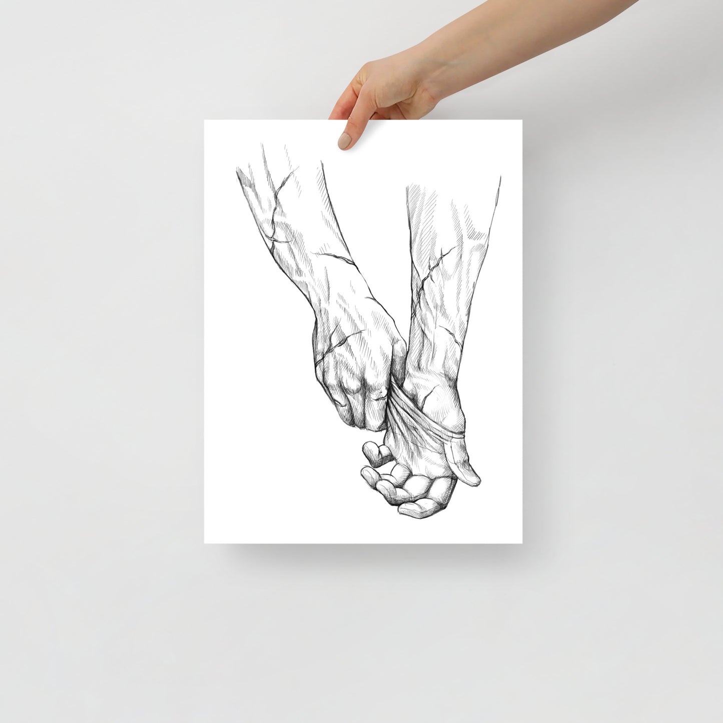 Scarred Hands